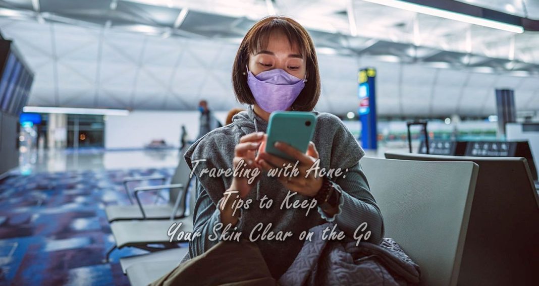 Traveling with Acne: Tips to Keep Your Skin Clear on the Go